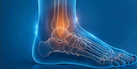 Foot and ankle x-ray illustration